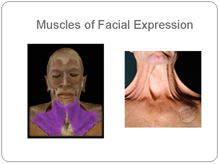 Muscles of Facial Expression 