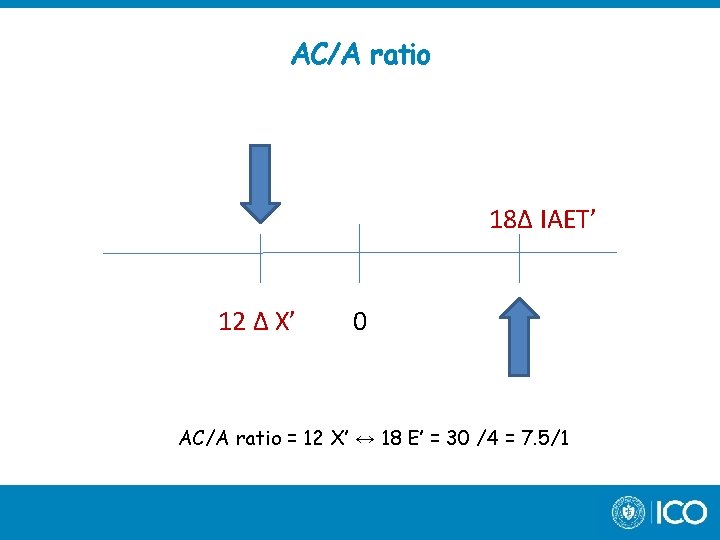 AC/A ratio 18∆ IAET’ 12 ∆ X’ 0 AC/A ratio = 12 X’ ↔