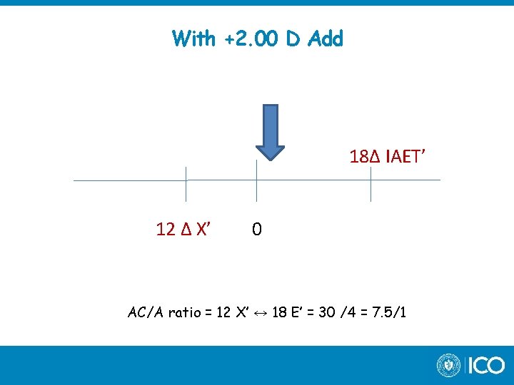 With +2. 00 D Add 18∆ IAET’ 12 ∆ X’ 0 AC/A ratio =