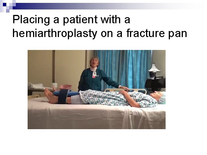 Placing a patient with a hemiarthroplasty on a fracture pan 