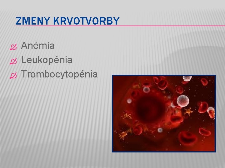 ZMENY KRVOTVORBY Anémia Leukopénia Trombocytopénia 