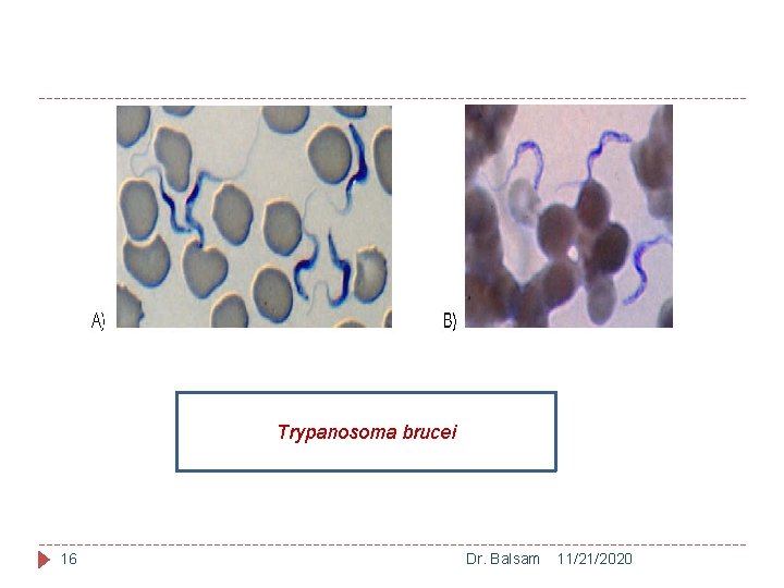 Trypanosoma brucei 16 Dr. Balsam 11/21/2020 