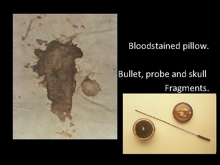 Bloodstained pillow. Bullet, probe and skull Fragments. 