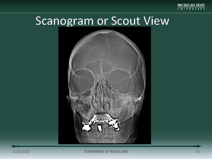 Scanogram or Scout View 11/21/2020 DEPARTMENT OF RADIOLOGY 15 
