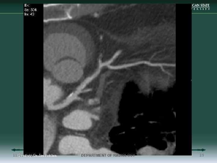 11/21/2020 Courtesy Dr. Jim Potchen DEPARTMENT OF RADIOLOGY 25 