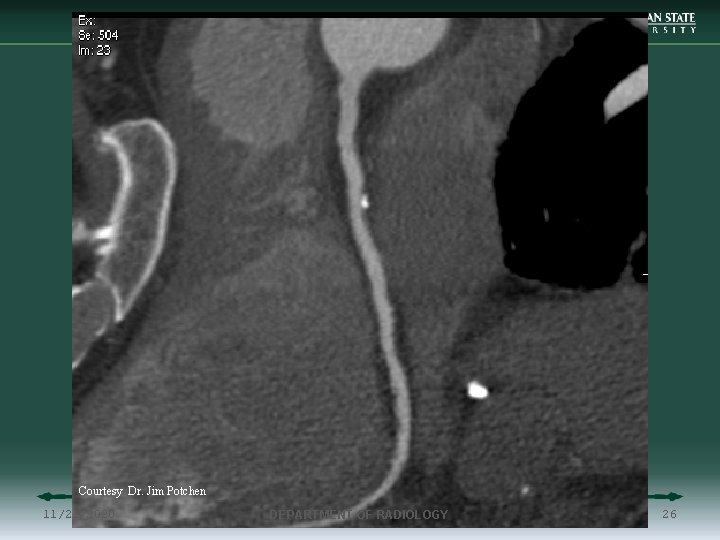 Courtesy Dr. Jim Potchen 11/21/2020 DEPARTMENT OF RADIOLOGY 26 