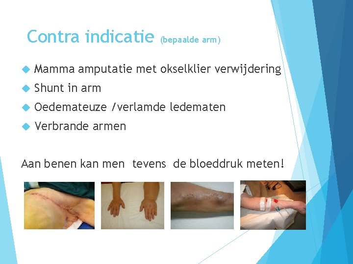 Contra indicatie (bepaalde arm) Mamma amputatie met okselklier verwijdering Shunt in arm Oedemateuze /verlamde