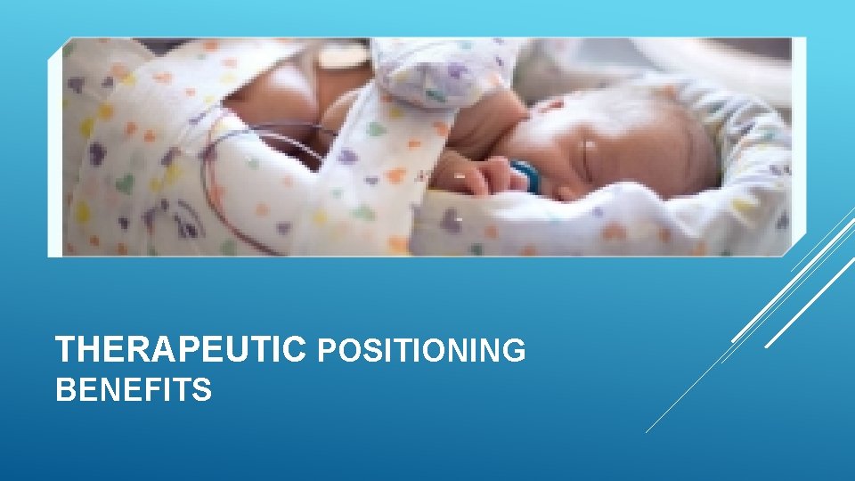 THERAPEUTIC POSITIONING BENEFITS 