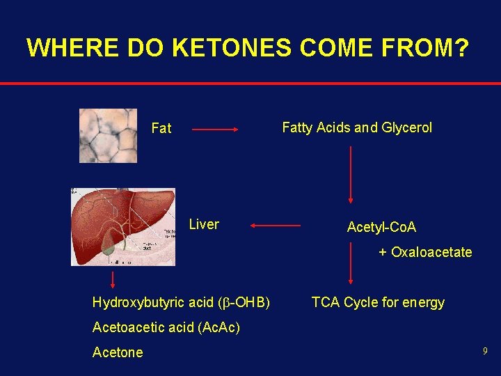 WHERE DO KETONES COME FROM? Fatty Acids and Glycerol Fat Liver Acetyl-Co. A +