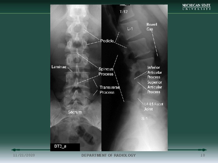 11/21/2020 DEPARTMENT OF RADIOLOGY 10 