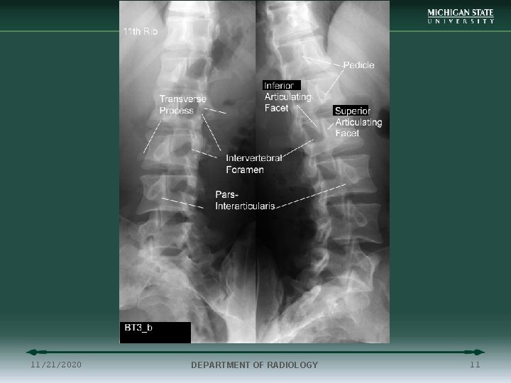 11/21/2020 DEPARTMENT OF RADIOLOGY 11 