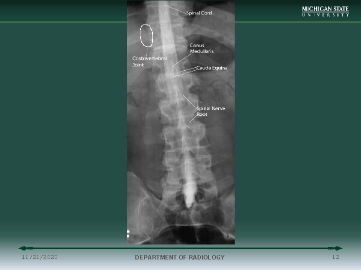 11/21/2020 DEPARTMENT OF RADIOLOGY 12 
