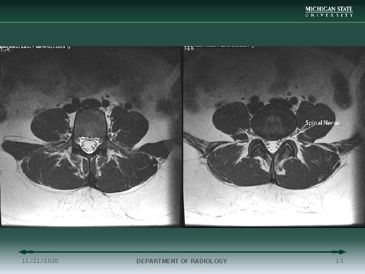 11/21/2020 DEPARTMENT OF RADIOLOGY 13 