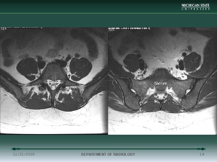 11/21/2020 DEPARTMENT OF RADIOLOGY 14 