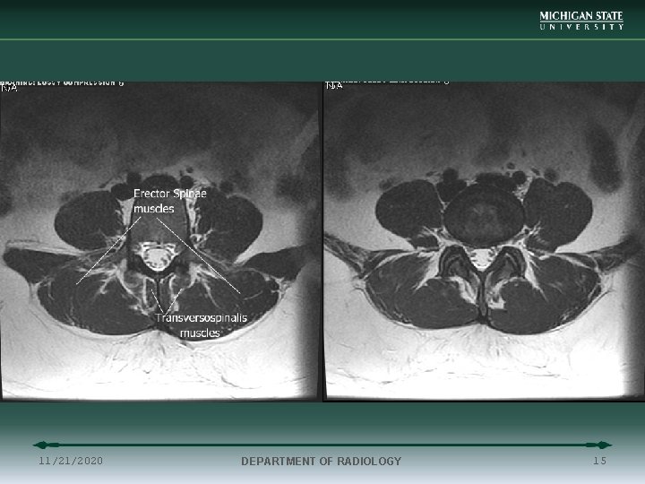 11/21/2020 DEPARTMENT OF RADIOLOGY 15 