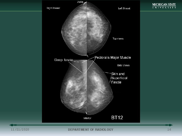11/21/2020 DEPARTMENT OF RADIOLOGY 16 
