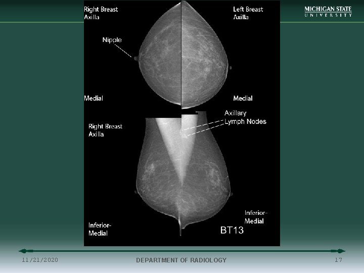 11/21/2020 DEPARTMENT OF RADIOLOGY 17 