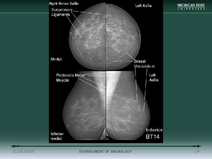 11/21/2020 DEPARTMENT OF RADIOLOGY 18 
