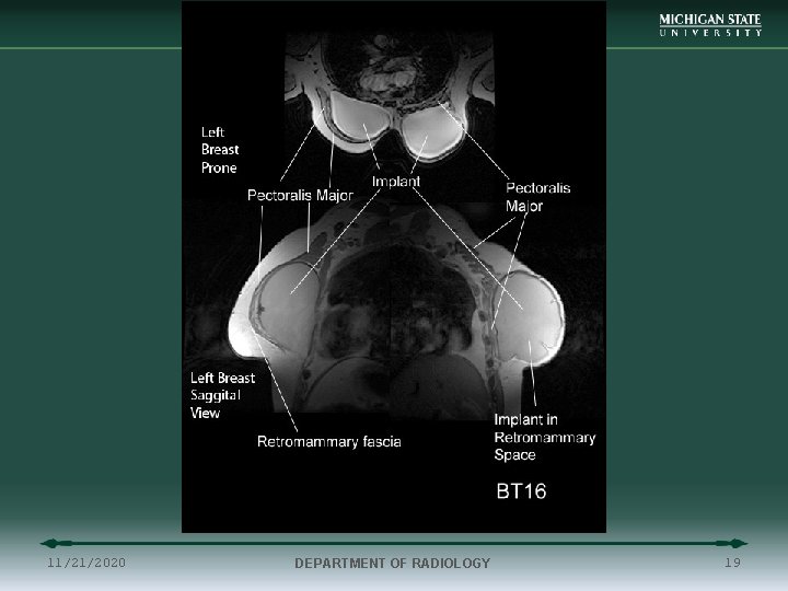 11/21/2020 DEPARTMENT OF RADIOLOGY 19 