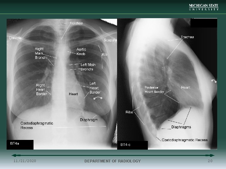 11/21/2020 DEPARTMENT OF RADIOLOGY 20 
