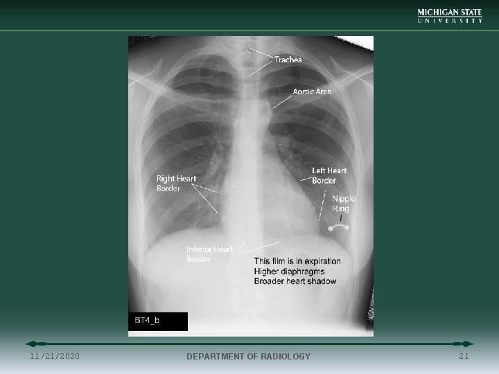 11/21/2020 DEPARTMENT OF RADIOLOGY 21 