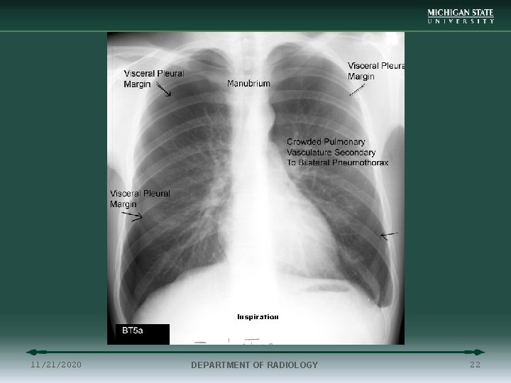 11/21/2020 DEPARTMENT OF RADIOLOGY 22 