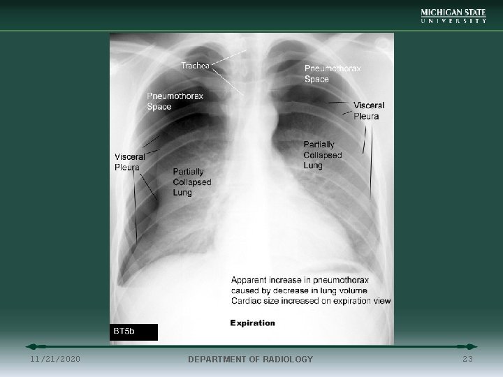 11/21/2020 DEPARTMENT OF RADIOLOGY 23 