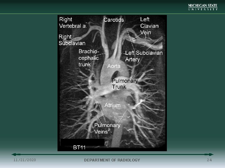 11/21/2020 DEPARTMENT OF RADIOLOGY 24 
