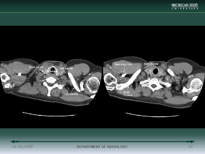 11/21/2020 DEPARTMENT OF RADIOLOGY 25 