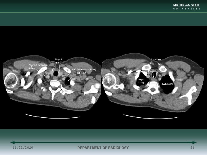 11/21/2020 DEPARTMENT OF RADIOLOGY 26 