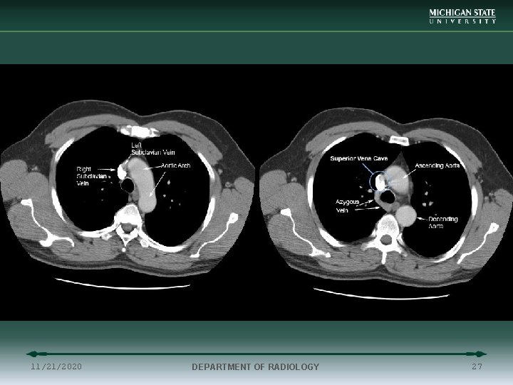 11/21/2020 DEPARTMENT OF RADIOLOGY 27 