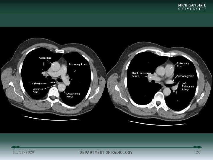 11/21/2020 DEPARTMENT OF RADIOLOGY 28 