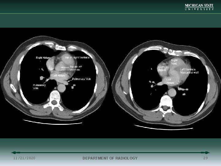 11/21/2020 DEPARTMENT OF RADIOLOGY 29 