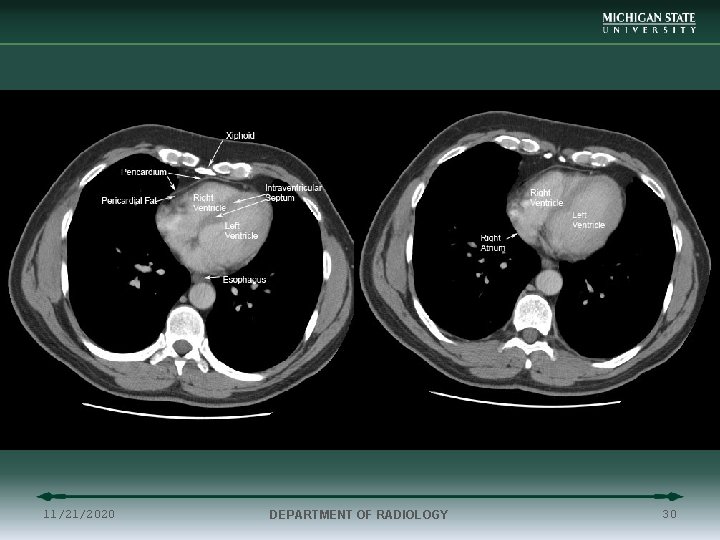 11/21/2020 DEPARTMENT OF RADIOLOGY 30 