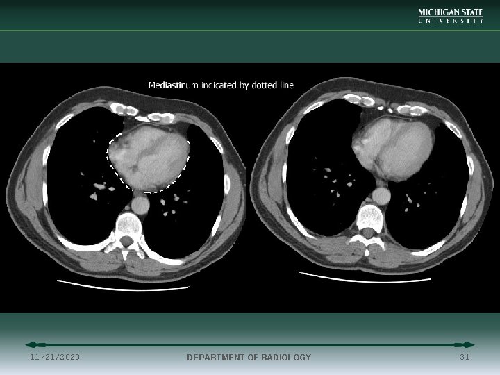 11/21/2020 DEPARTMENT OF RADIOLOGY 31 