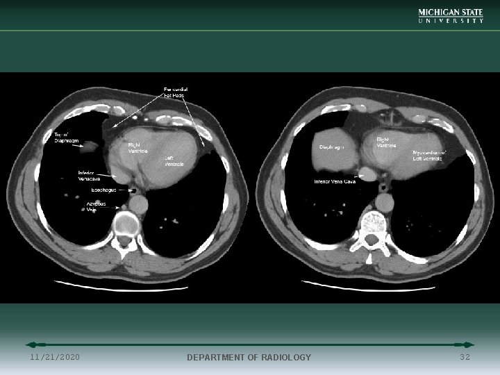 11/21/2020 DEPARTMENT OF RADIOLOGY 32 