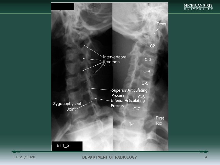 11/21/2020 DEPARTMENT OF RADIOLOGY 4 