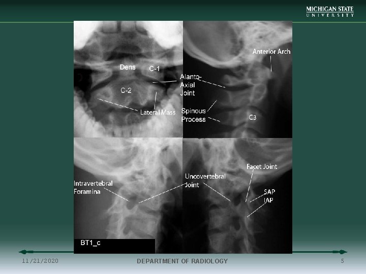 11/21/2020 DEPARTMENT OF RADIOLOGY 5 