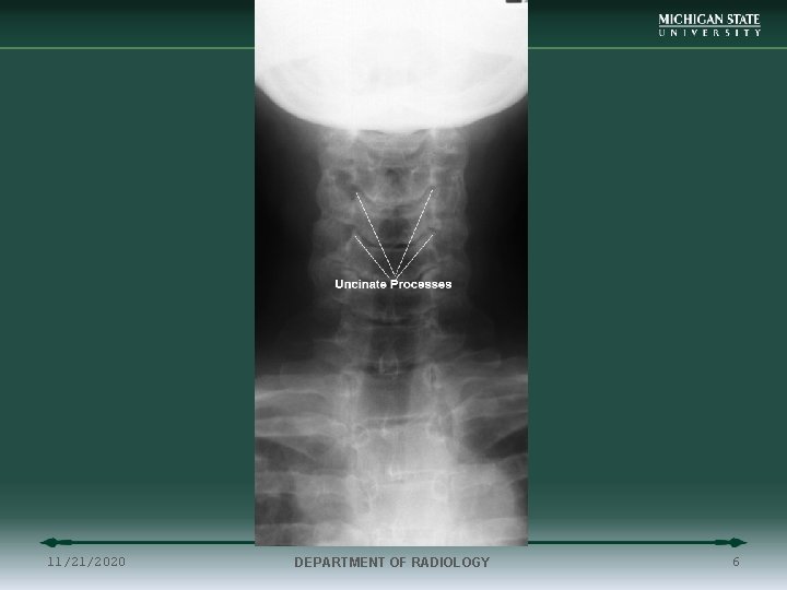 11/21/2020 DEPARTMENT OF RADIOLOGY 6 