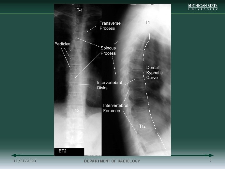 11/21/2020 DEPARTMENT OF RADIOLOGY 7 