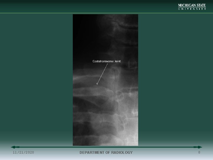 11/21/2020 DEPARTMENT OF RADIOLOGY 8 