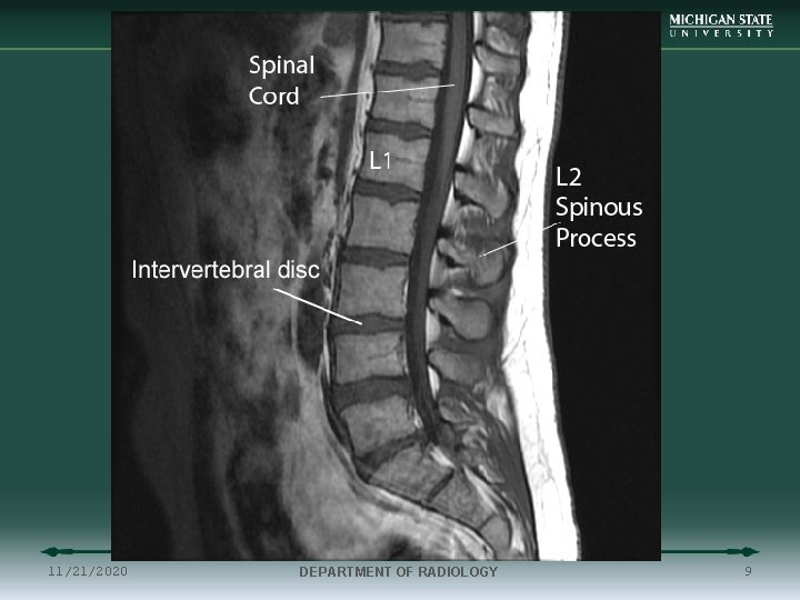 11/21/2020 DEPARTMENT OF RADIOLOGY 9 