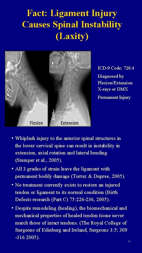 Fact: Ligament Injury Causes Spinal Instability (Laxity) ICD-9 Code: 728. 4 Diagnosed by Flexion/Extension