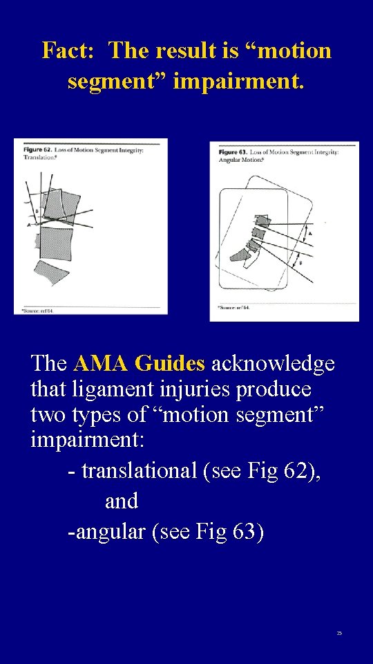 Fact: The result is “motion segment” impairment. The AMA Guides acknowledge that ligament injuries