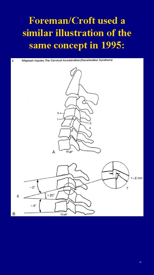 Foreman/Croft used a similar illustration of the same concept in 1995: 26 