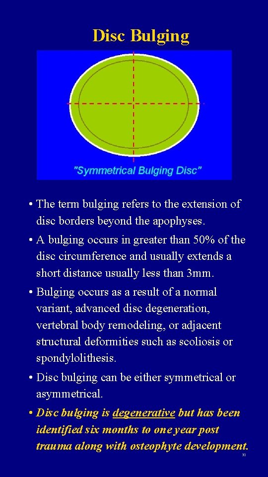 Disc Bulging • The term bulging refers to the extension of disc borders beyond