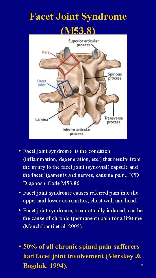 Facet Joint Syndrome (M 53. 8) • Facet joint syndrome is the condition (inflammation,