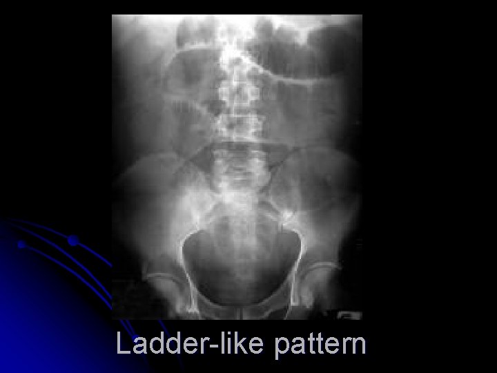 Ladder-like pattern 