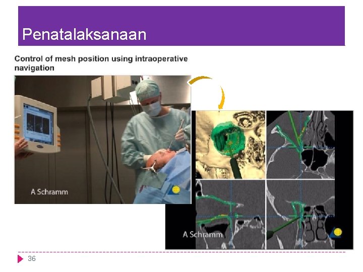 Penatalaksanaan 36 