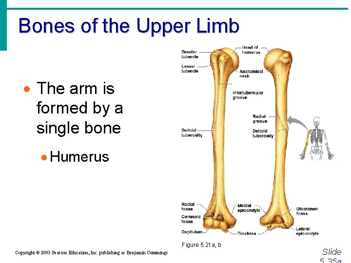 Bones of the Upper Limb · The arm is formed by a single bone